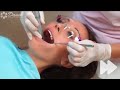 Комплексная ультразвуковая и пескоструйная чистка зубов в Волжском (стоматология ДАША)