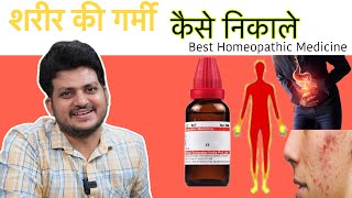 शरीर की गर्मी कैसे निकाले | Body Heat | Acidity | Best Homeopathic Medicine