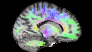 Imeka Tractography Service