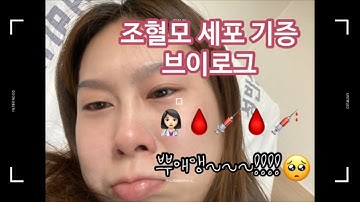 [onyeelog] 조혈모세포 기증 후기 브이로그!! 조혈모세포 기증하고 왔어요~~ 입원한 이야기 들려드릴게요?