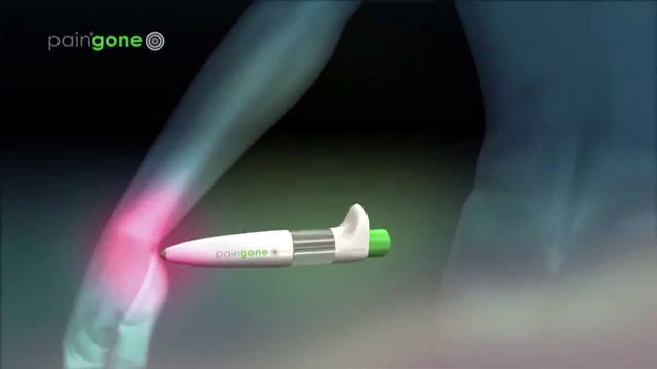 Pain Gone Pen - How It Works - YouTube