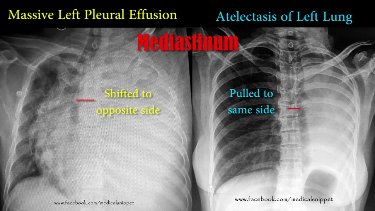 12++ Diagnostic Imaging Chest Pdf at Demax5