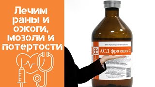 АСД лечим раны и ожоги, мозоли и потертости АСД лечим раны и ожоги, мозоли и потертости