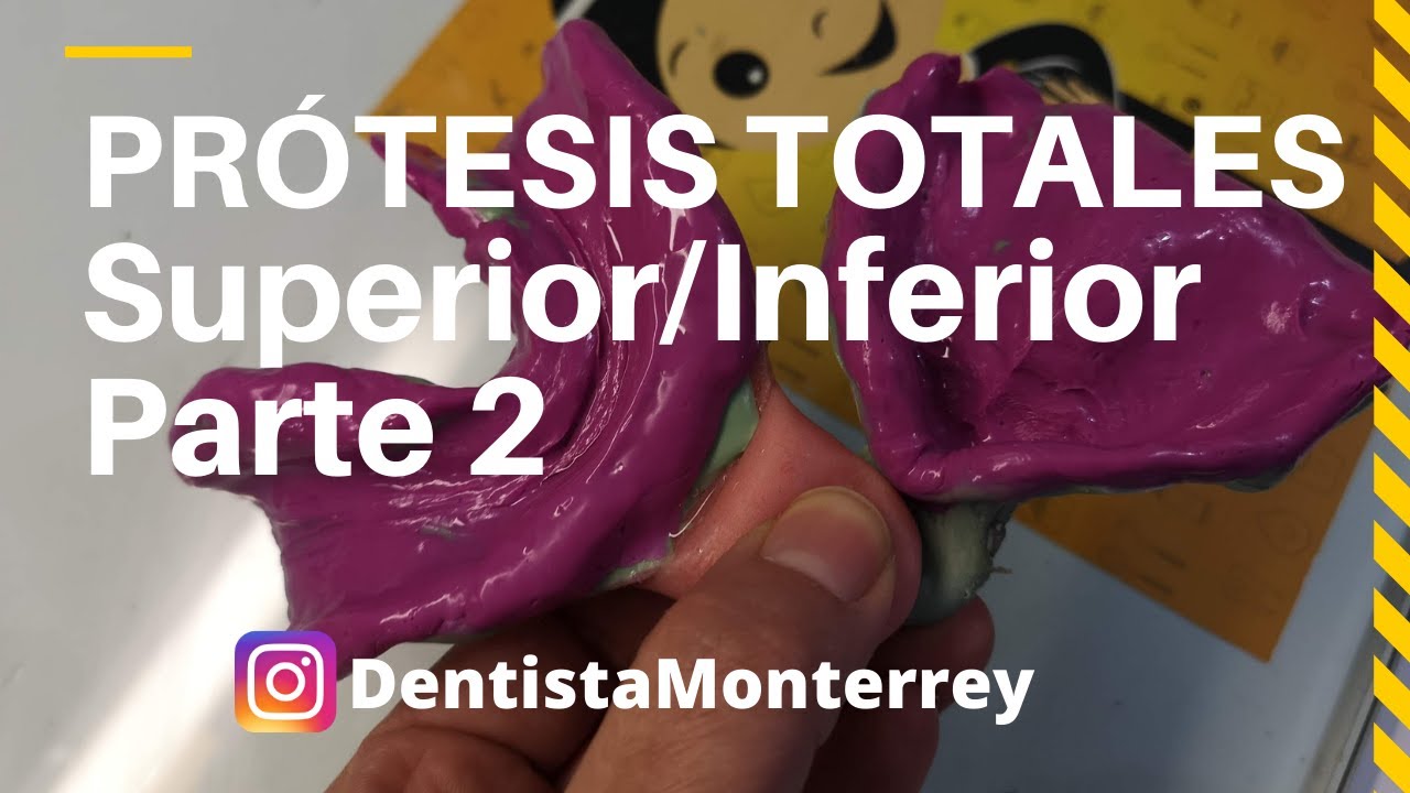 PASOS Prácticos #ProtesisTotales 👅Parte2 Cucharillas /Impresión dental #Dentaduracompleta #dental