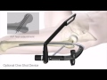 Stryker Trauma & Extremities | Femoral Nailing | One Shot Device