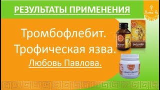 Тромбофлебит. Трофическая язва. Результаты применения продуктов Вита-Ра. Любовь Павлова Тромбофлебит. Трофическая язва. Результаты применения продуктов Вита-Ра. Любовь Павлова