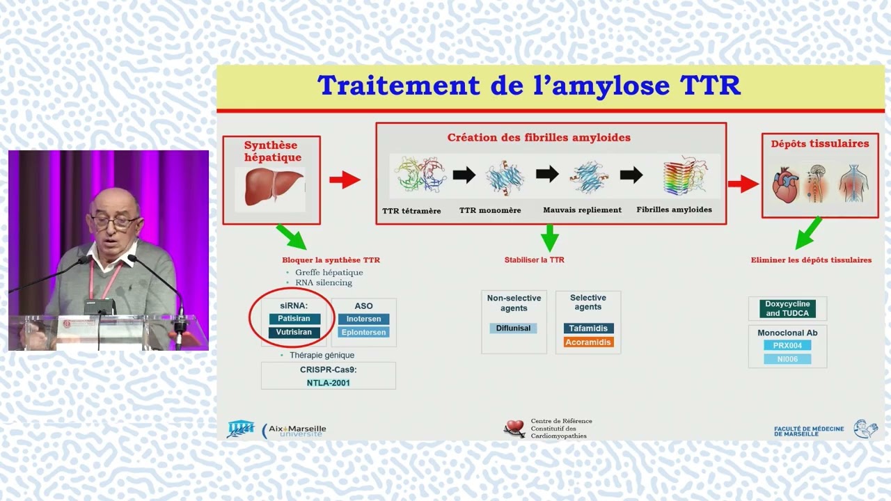 Actualités thérapeutiques dans l’amylose : où en est-on ?
