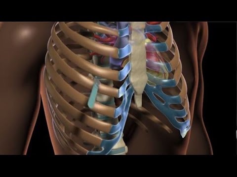 Video: Latihan Pectus Excavatum: Meningkatkan Kekuatan