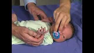 02/23. Clinical Pediatrics: Galant Reflex. 02/23. Clinical Pediatrics: Galant Reflex.