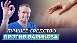 видео: Варикозное расширение вен: причины и упражнение для профилактики картинка: Варикозное расширение вен: причины и упражнение для профилактики