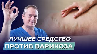 КАК ИЗБАВИТЬСЯ ОТ ВАРИКОЗА | ШКОЛА ЗДОРОВЬЯ и доктор Божьев