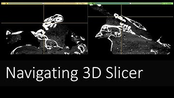 Navigating 3D Slicer | Introduction to Digital Preparation Video 8