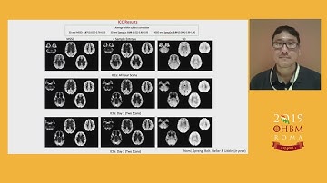 OHBM 2019 | Symposium | Characterizing Resting - State BOLD Brain Signal Variability in Typica…