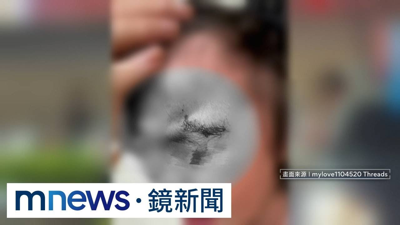 幼兒園內飼養米克斯無牽繩嘴套　失控咬傷女童臉部｜#鏡新聞