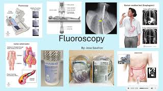 3MT   Fluoroscopy