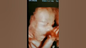Sleepy Baby Boy 5D Video