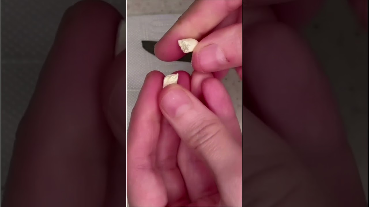 ТАКИЕ РАЗНЫЕ ПРОБИОТИКИ ! (Под микроскопом)