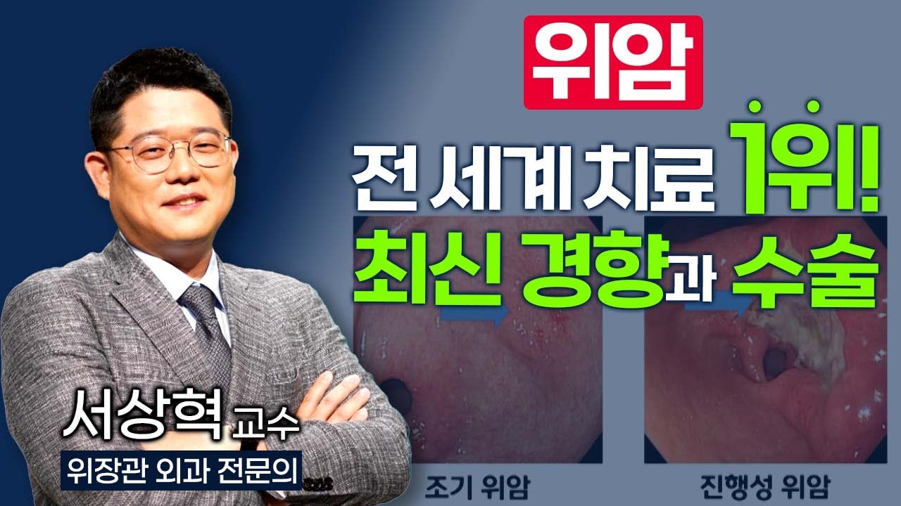 전 세계에서 위암 치료 1등! 대한민국에서 위암에 대한 모든 것과 최신 치료의 경향을 알려 드립니다 / 부산mbc TV닥터인사이드 221003 방송