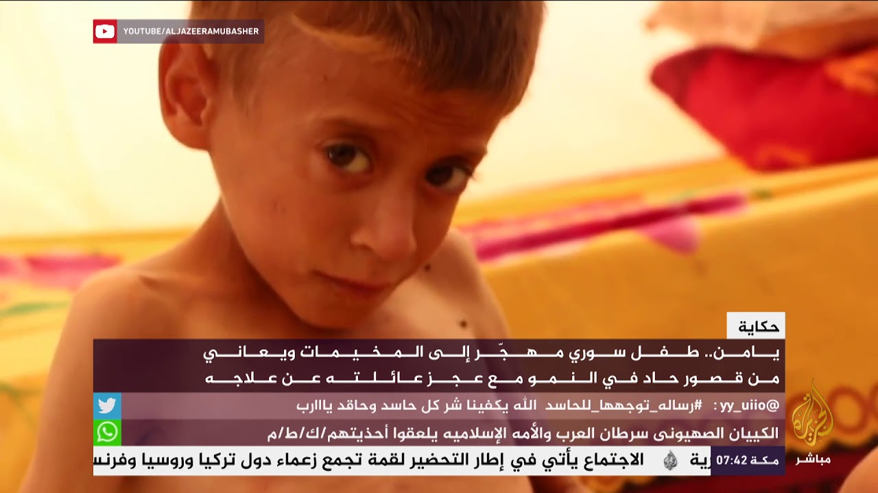 حكاية مؤثرة .. طفل سوري يعاني من قصور حاد في النمو مع عجز عائلته عن علاجه
