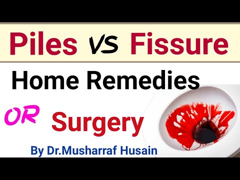 Piles Treatment at Home | Piles and Fissure Difference | Hemorrhoids Symptoms Causes and Treatment