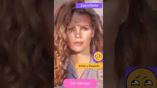 Kim Basinger Antes y después shorts