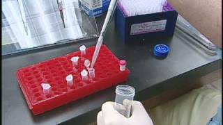 Womens Hands Have More Bacteria Than Mens
You might have heard about new research that showed girls hands have more bacteria than guys... But it gets even weirder. Your right hand has different kinds of bacteria than your left, and hand washing is effective but ONLY for a short while. Before this sends you off to give your hands a scrubbing, check out this video for some more hand-y bacteria information.
http://www.sciencentral.com/video/ Womens Hands Have More Bacteria Than Mens