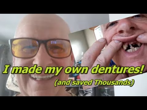 I made my own Dentures ( False Teeth)