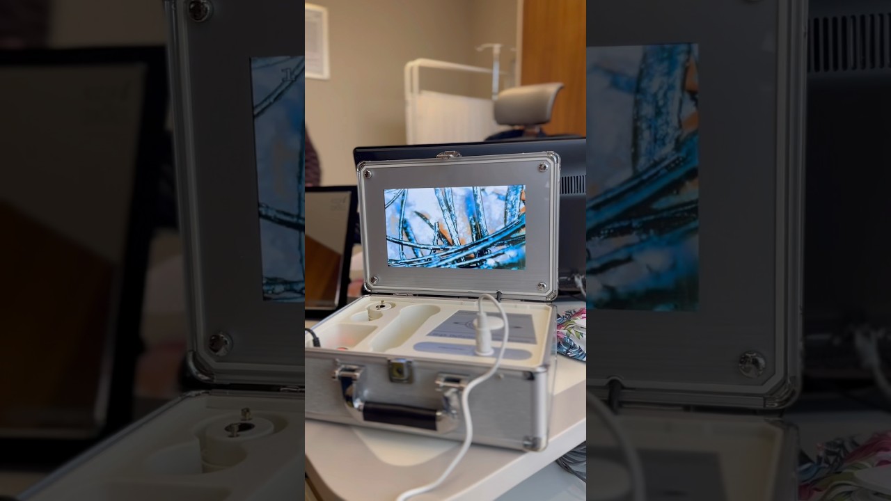 Hair Transplant Consultation