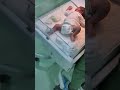 خدود اليوم