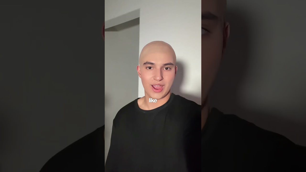 Would you go bald?