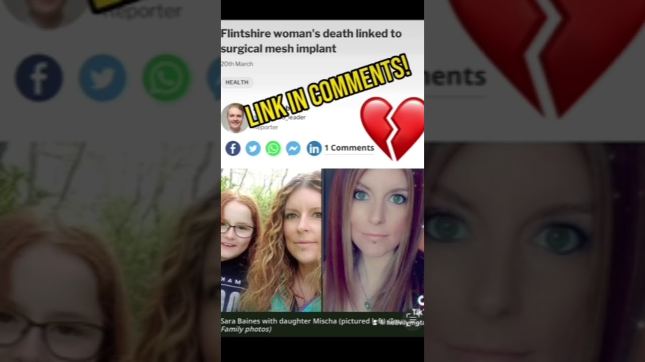 Death By Metal Implant! #metal #allergy #Implant