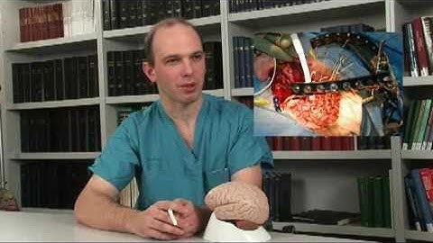 Interview with Jeffrey Ojemann, M D , neurosurgeon
