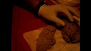 Clase de Neurofisiología 5