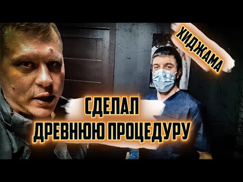 СДЕЛАЛ ДРЕВНЮЮ ПРОЦЕДУРУ