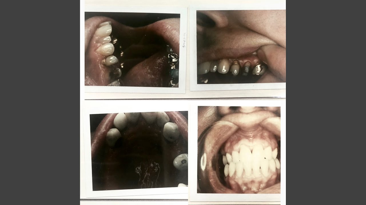 Watch man down. on YouTube Watch man down. on YouTube