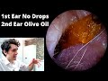 Ultra Sticky Ear Wax VS Olive Oil Treated Ear Wax