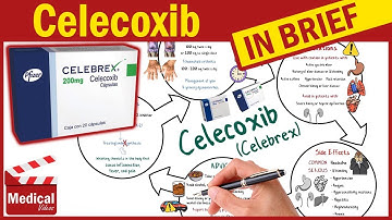 Celecoxib ( Celebrex ): What is Celecoxib Used For, Dosage, Side Effects & Precautions ?