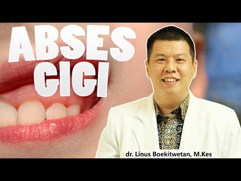 Abses Gigi - Apa itu ? Gejala dan Bahayanya - drg. Linus Boekitwetan, M.Kes