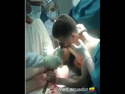 жесть МЕДЕЦИНА ХІРУРГІЯ І ДРУГОЕ