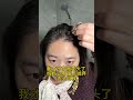 #脂溢性掉发 #养发护发 #增加发量