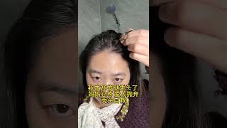 #脂溢性掉发 #养发护发 #增加发量