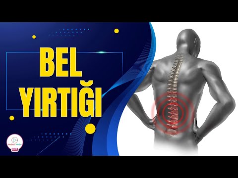 Video: Yırtıq disk ağrısını aradan qaldırmağın 4 yolu