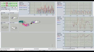 ProtoKinetics Movement Analysis Software (PKMAS)