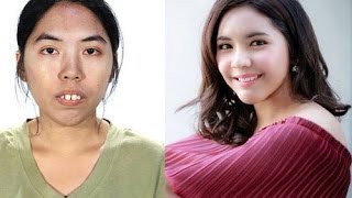 Wajah Cantik Karena Operasi Plastik