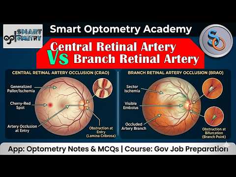 Part-3: CRAO vs BRAO- Central vs Branch Retinal Artery Occlusion
