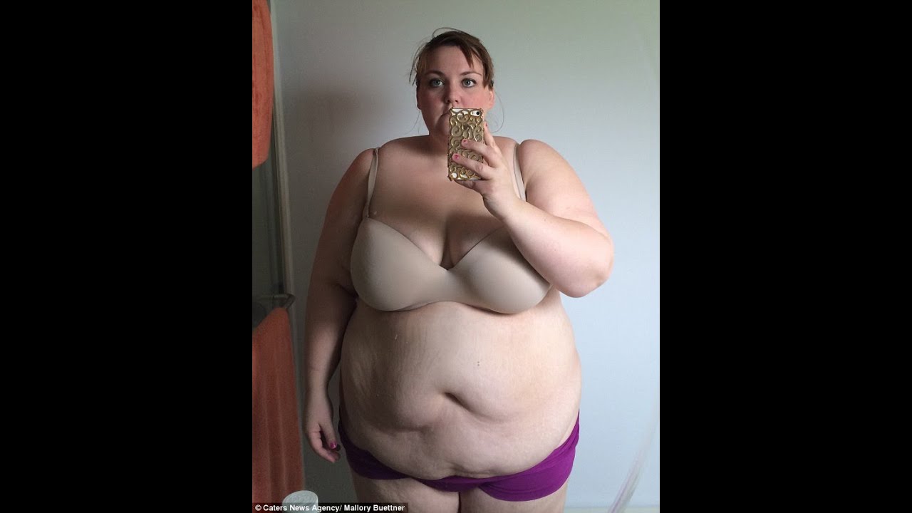 Obese Teacher Wears Bikini For The First Time After Losing 210 POUNDS - You...