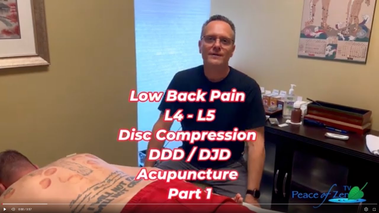 Acupuncture for Low Back Pain Relief | Disc Compression & Spinal Degeneration Treatment