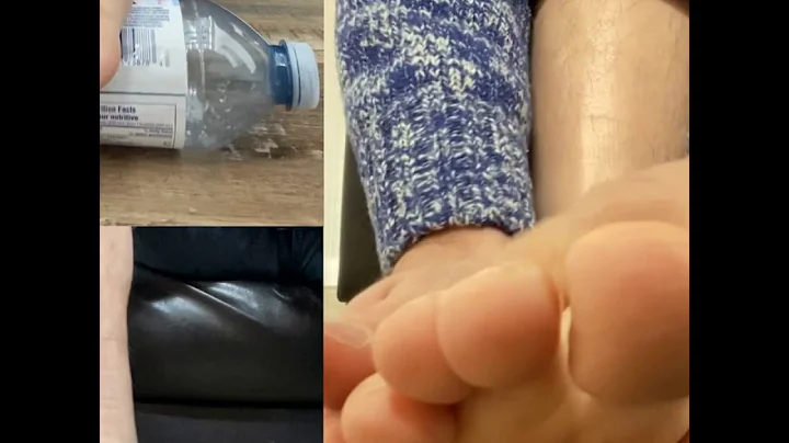 Morton's Neuroma: Sharp, Shooting Foot Pain Explained