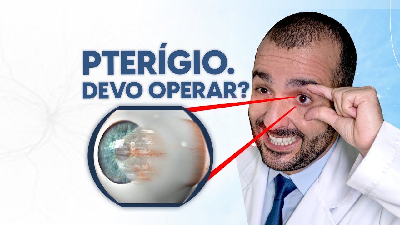 Descubra como curar o terçol rapidamente! – Dr. Gustavo Bonfadini