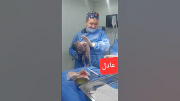 عادل عادل 